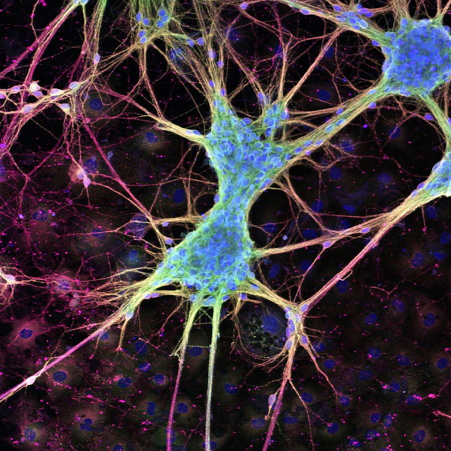 Microscopic image representing nerve cells